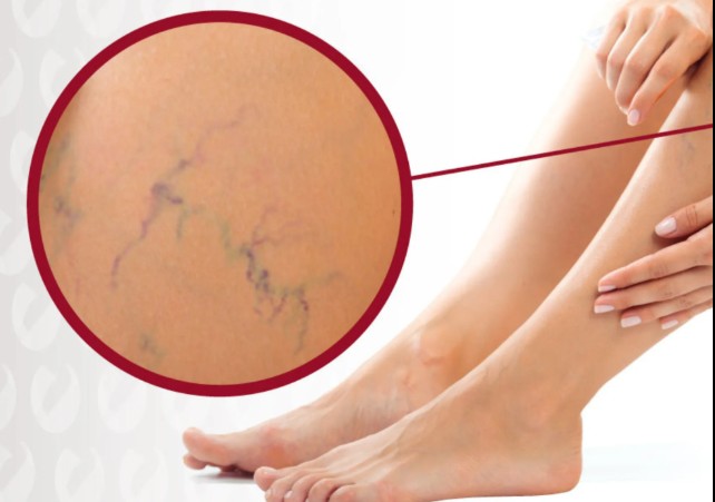 Secagem de Vasinhos (PEIM)