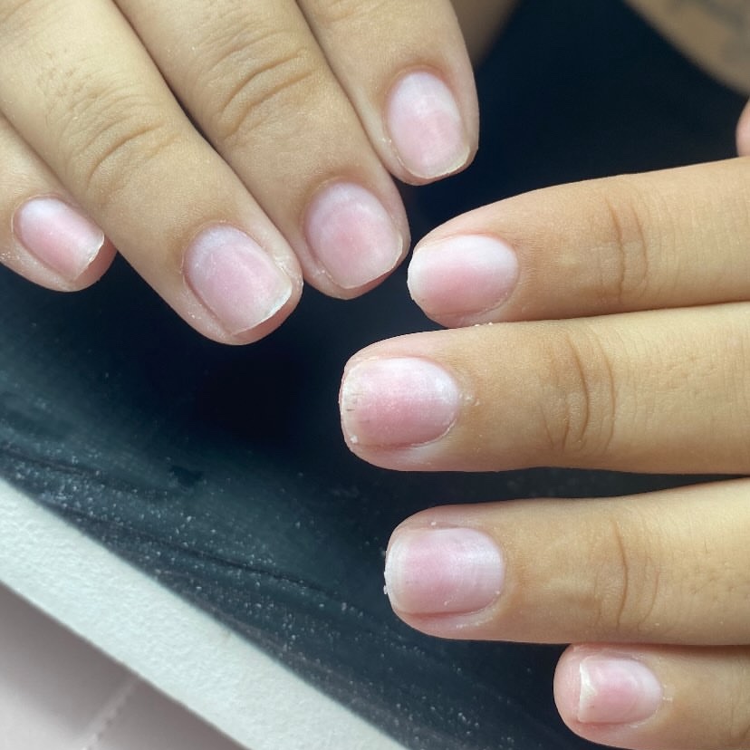 Remoção de alongamento