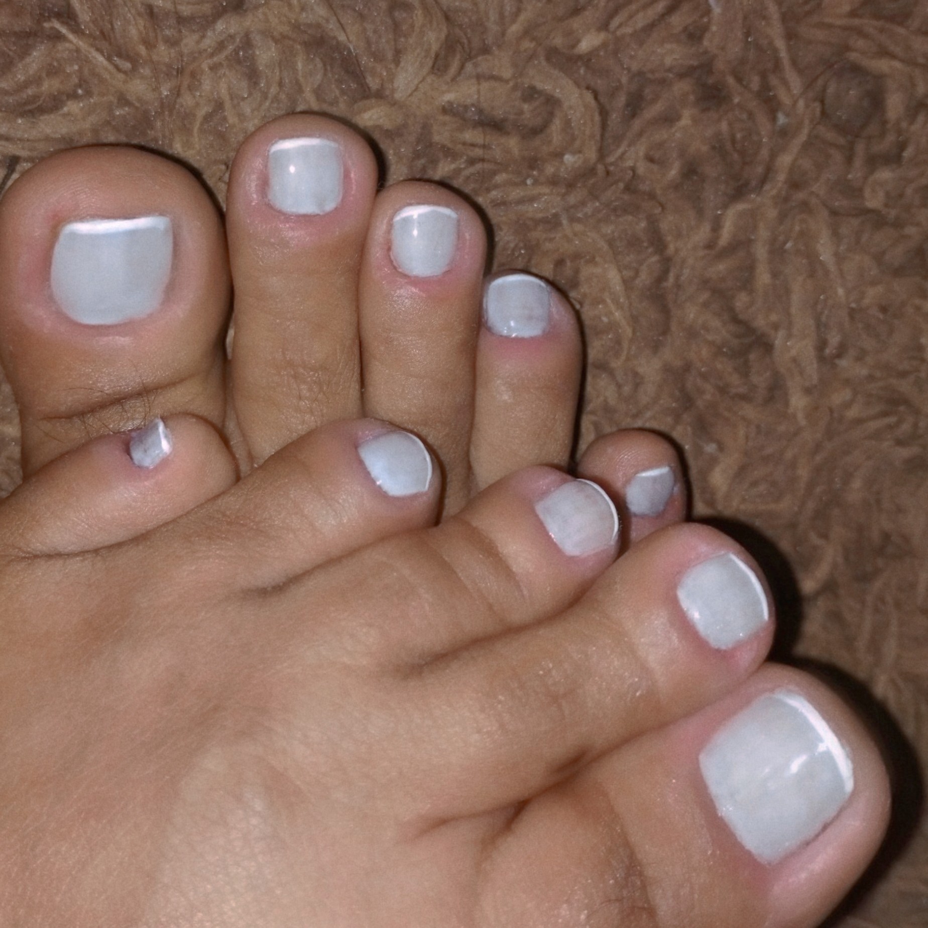 plástica dos pés + pedicure