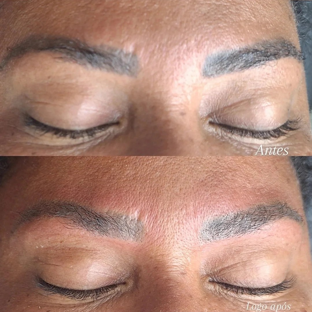 REPARAÇÃO TECIDUAL