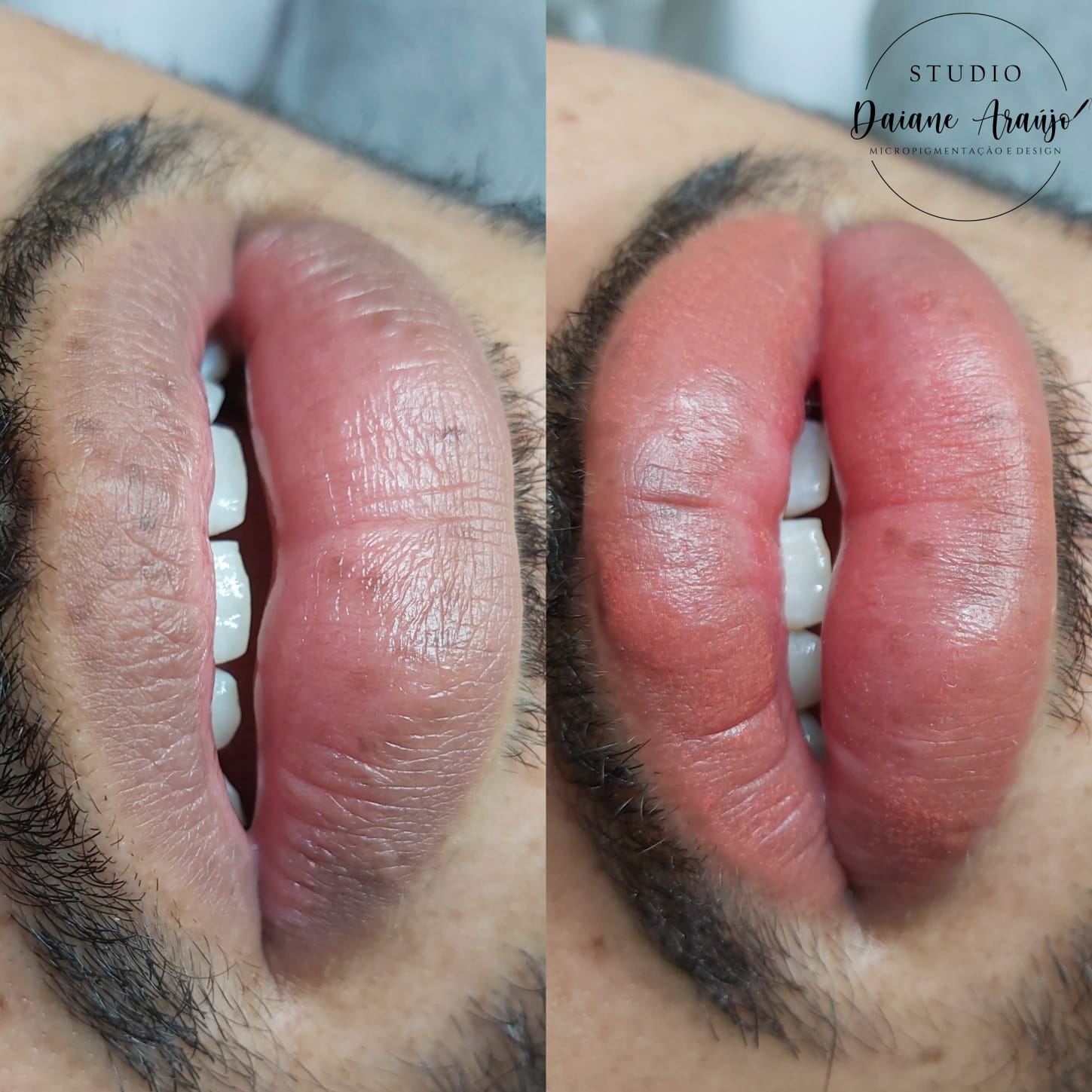 Micropigmentação labial masculina