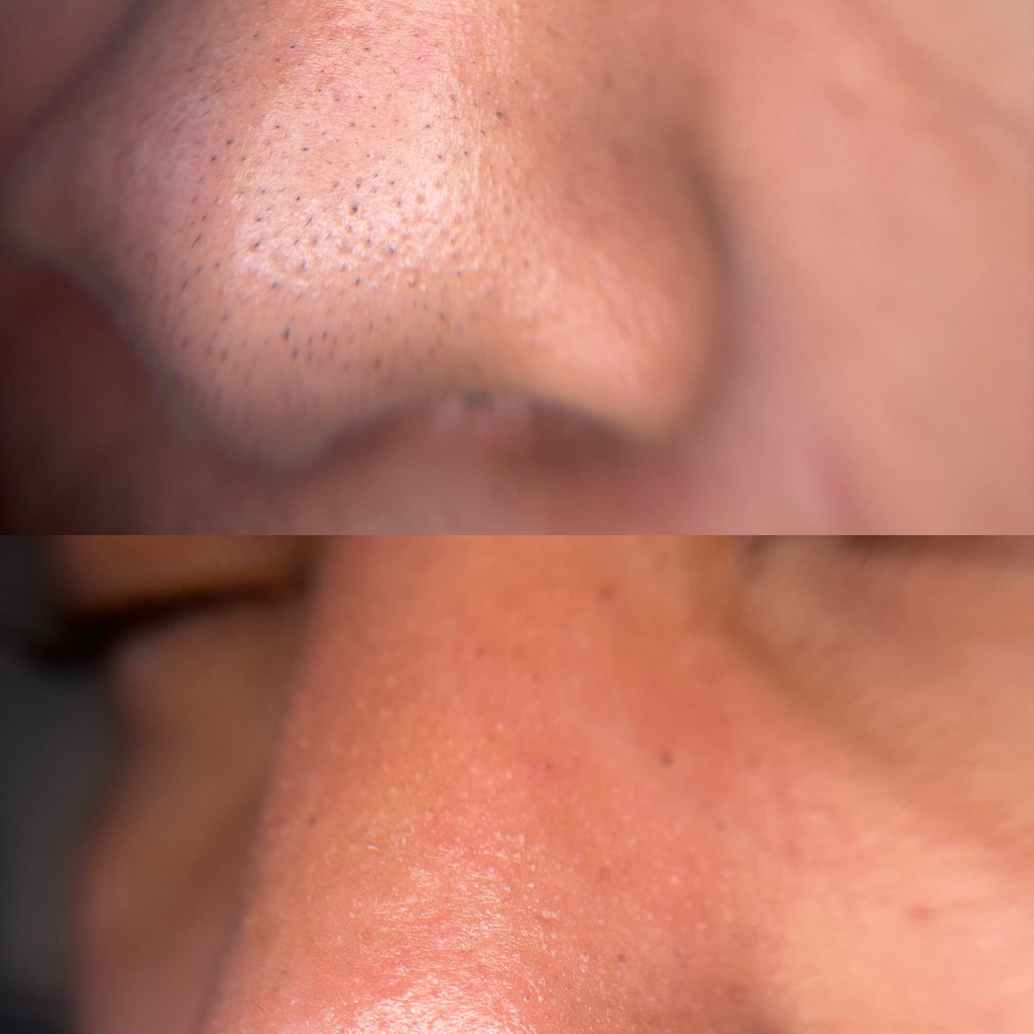 Limpeza de pele personalizada