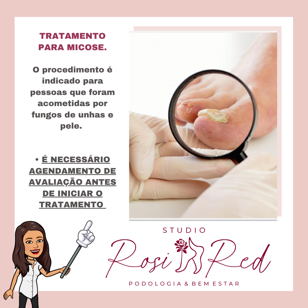 Avaliação Micose