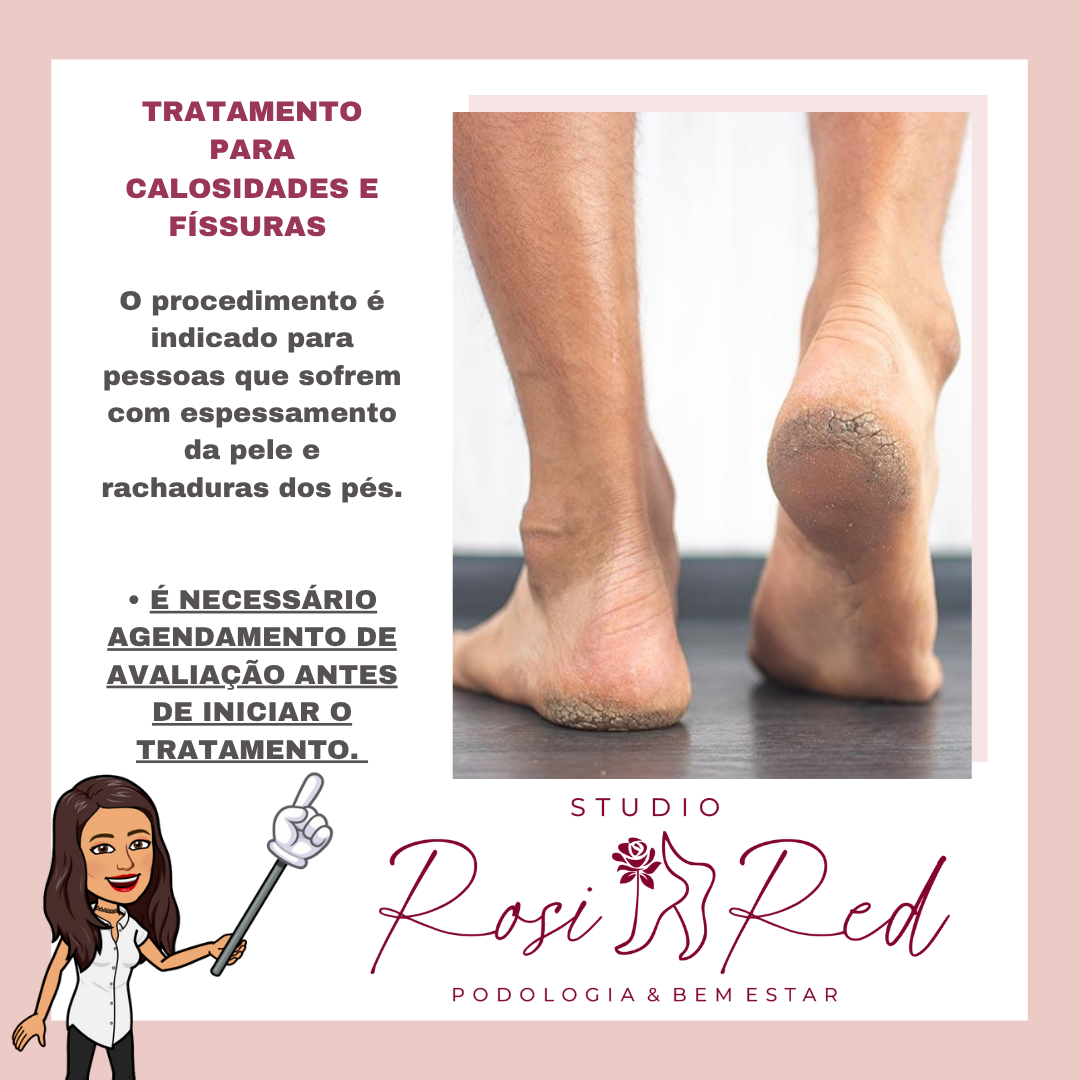 Avaliação Calosidades e rachaduras