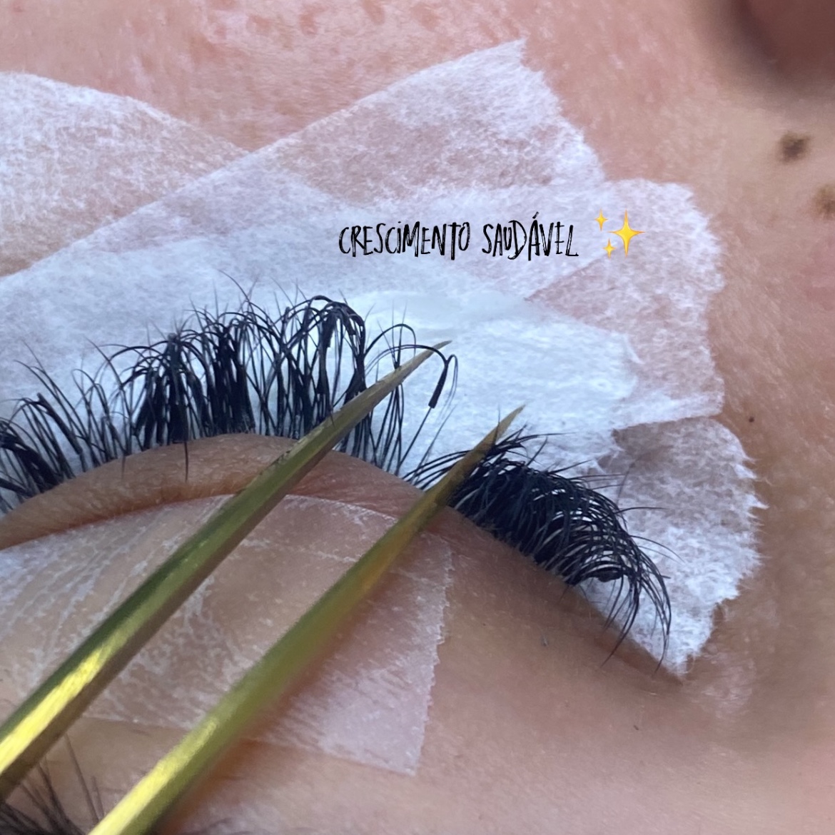 manutenção de 15 a 20 Dias Apois é remoção e nova aplicação