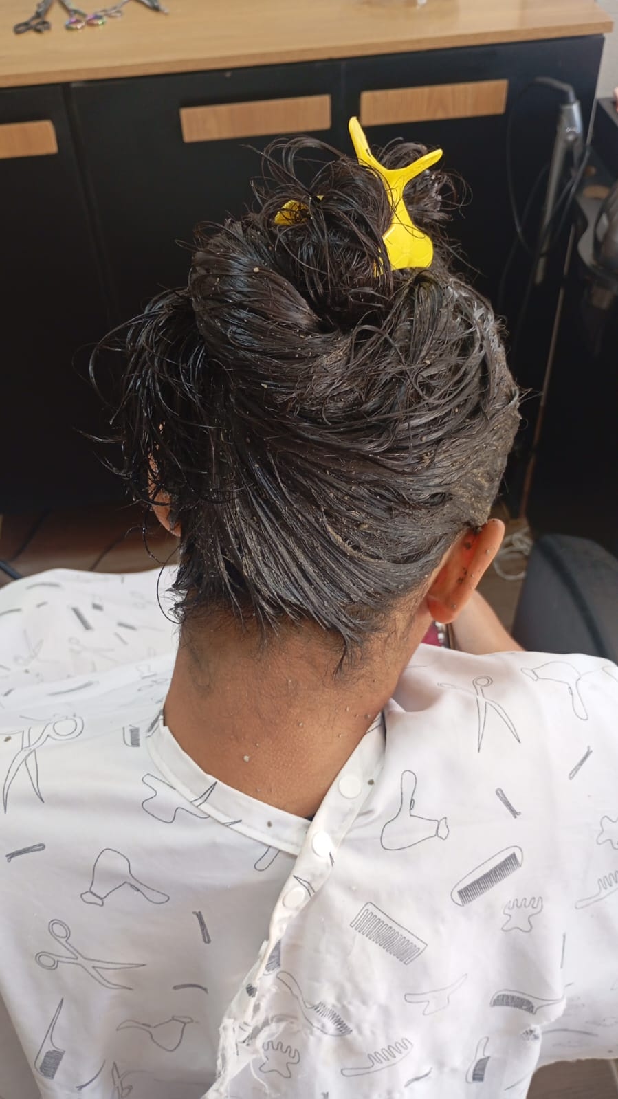 Tratamento dermatite ceborreica