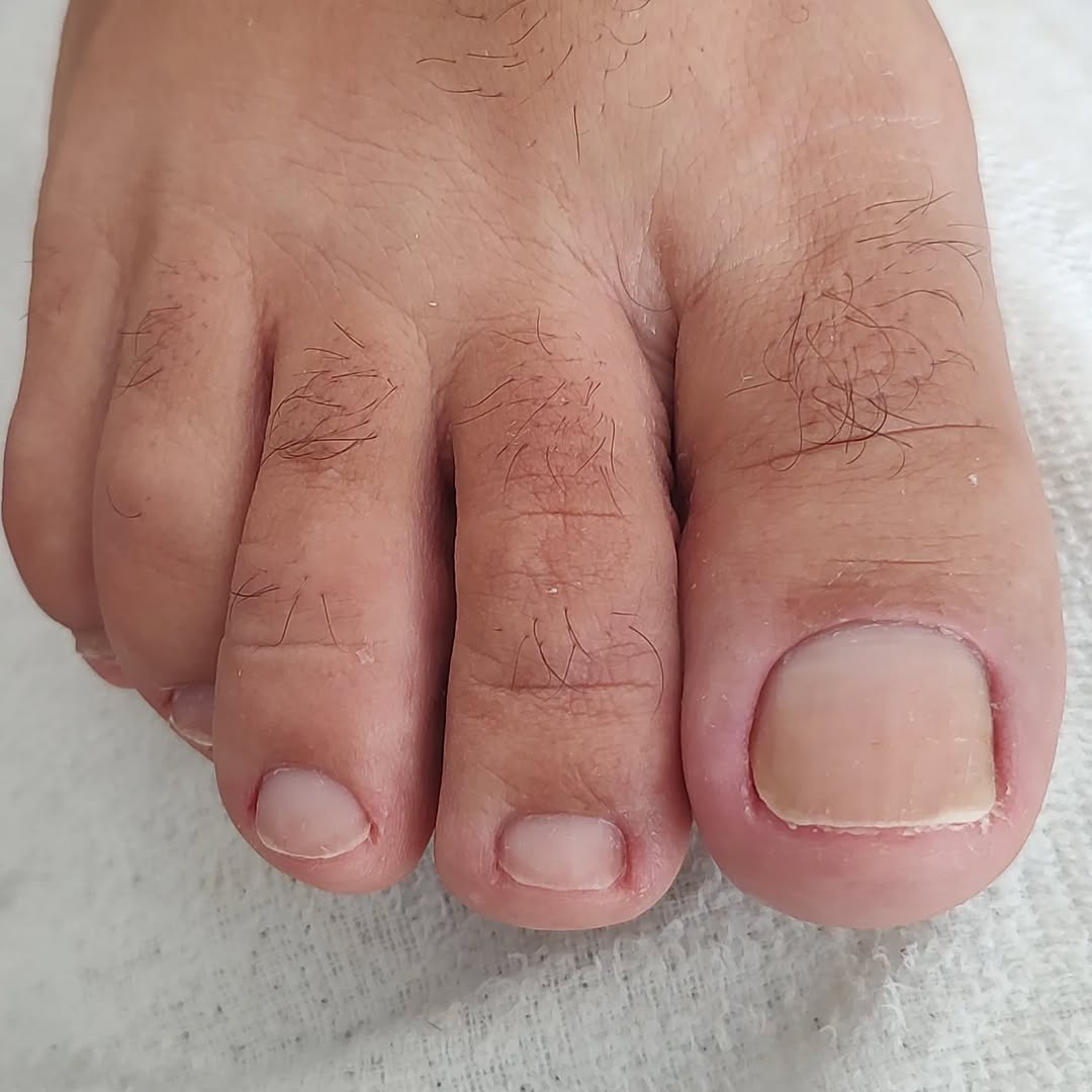 pedicure masculino
