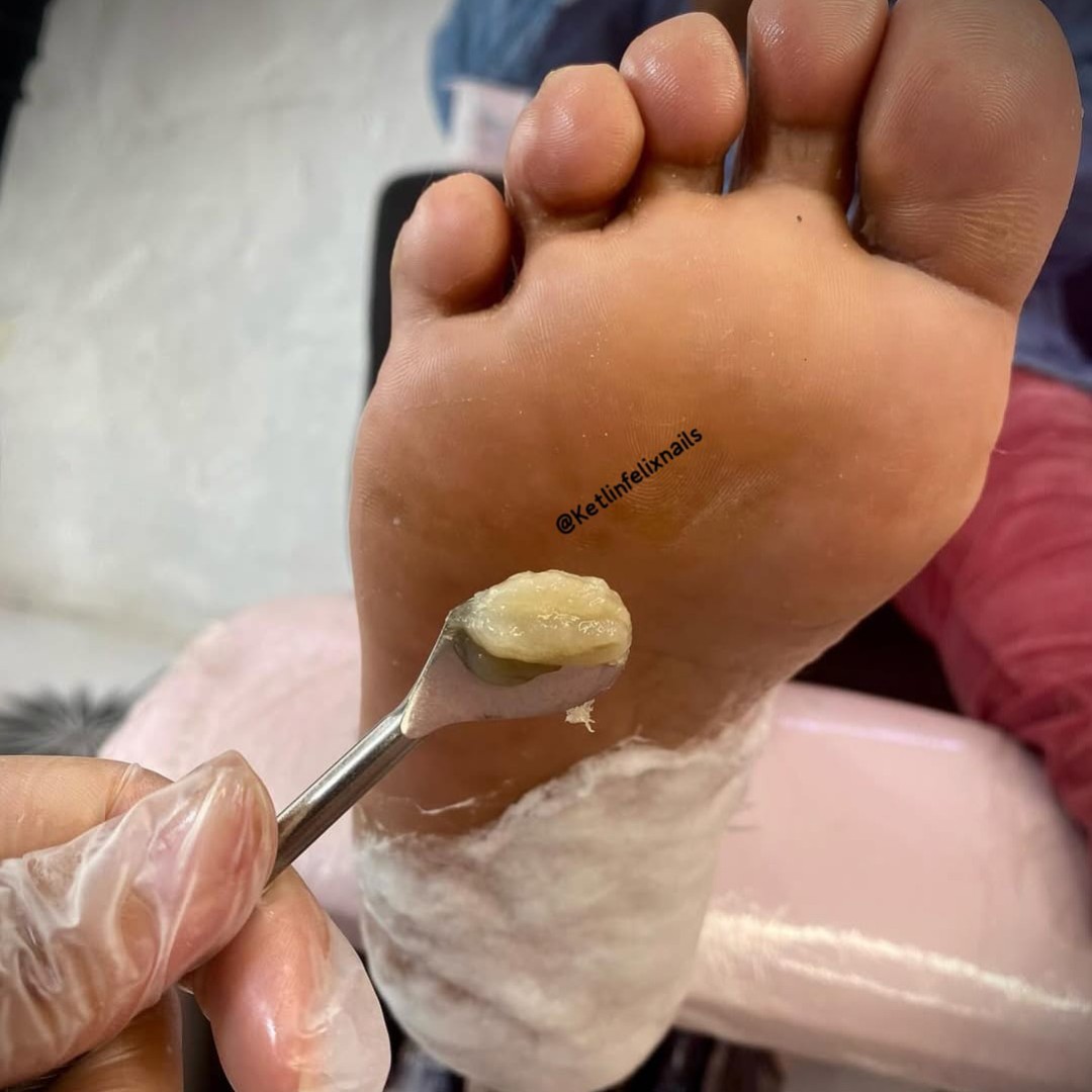 Plastica dos Pés+ Pedicure