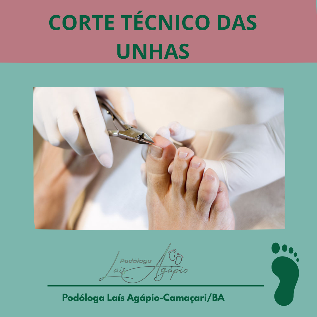 CORTE TÉCNICO DAS UNHAS - Podologia em Camaçari - BA