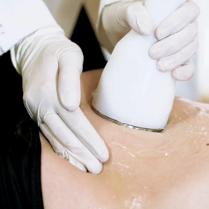 Ultrassom Estética (20min)