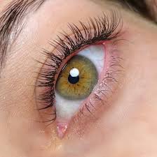 Extensão Clássica -  FIO A FIO