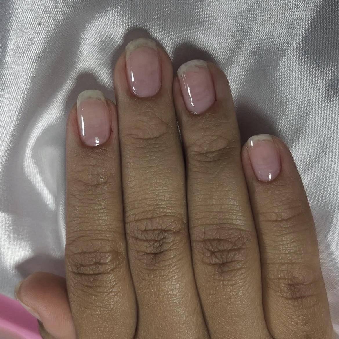 Remoção de alongamento