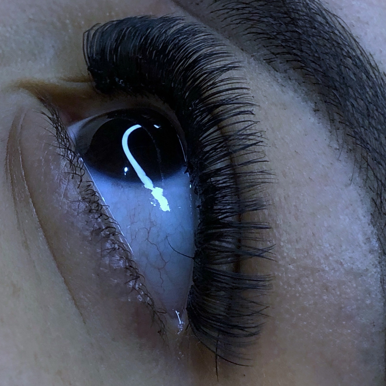 Tufo de Seda moderado