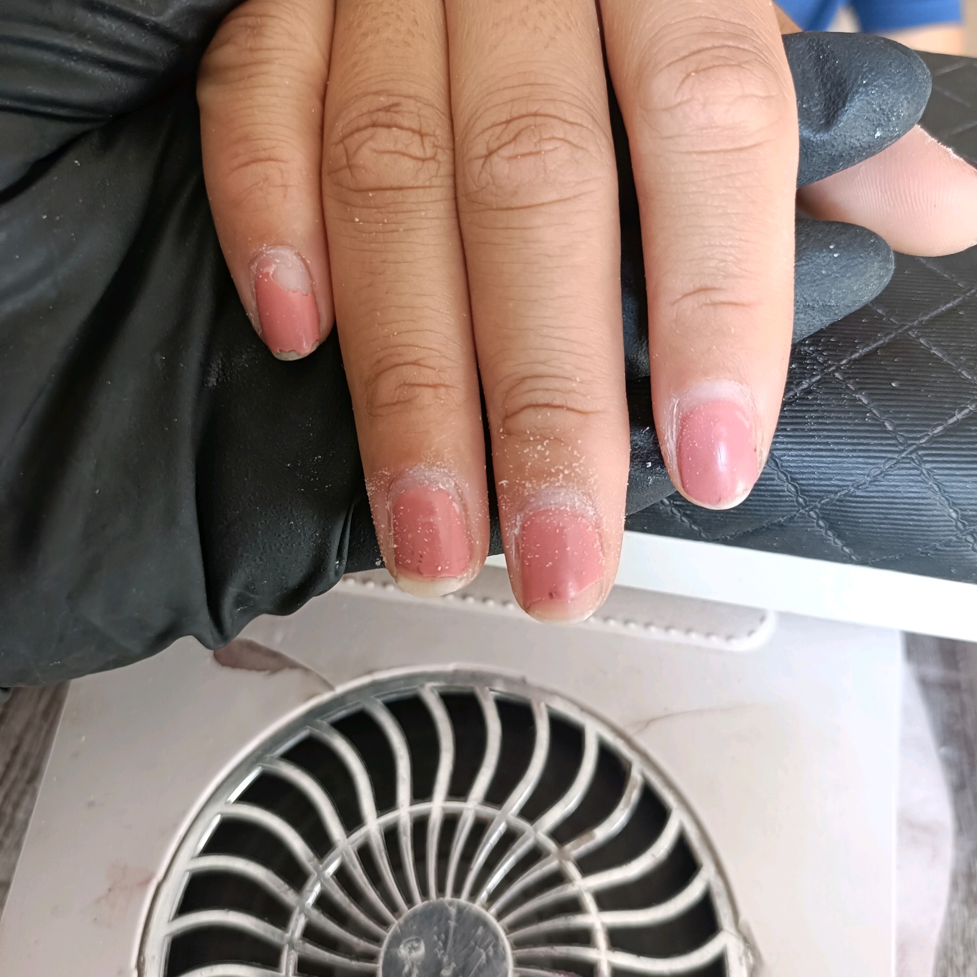 remoção de qualquer procedimento