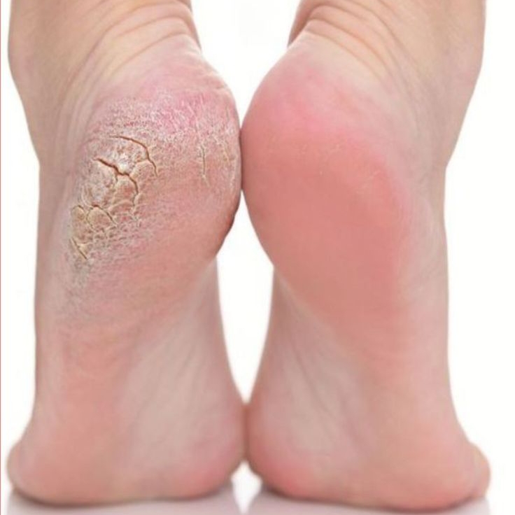 SPA dos pés com pedicure