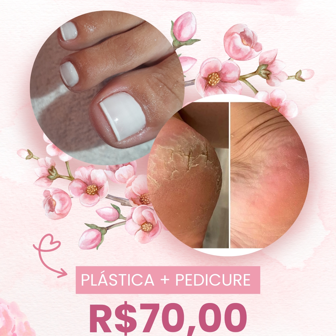 Promo Plástica dos Pés + Pedicure