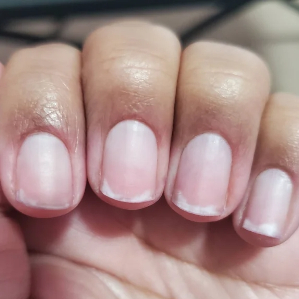 Limpeza do leito unguial