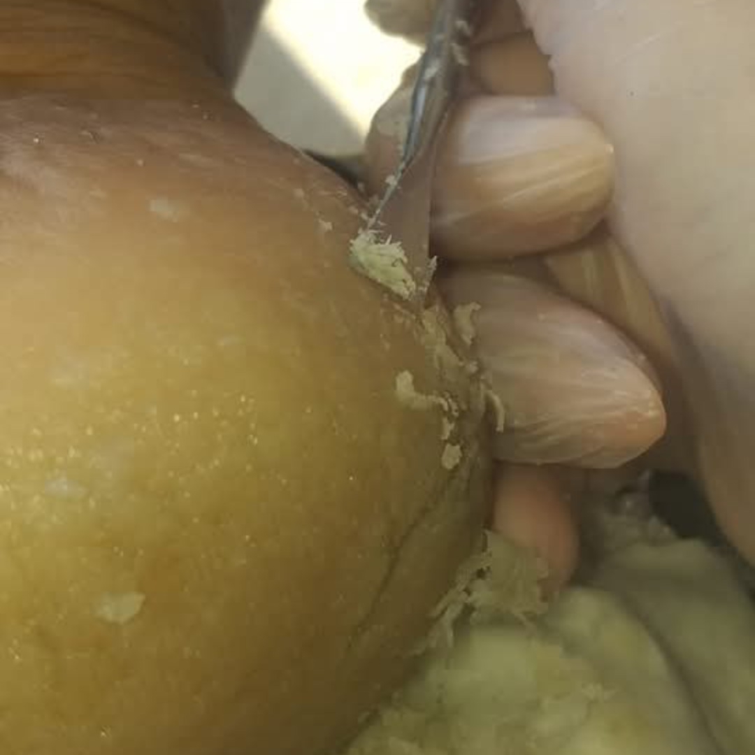 Plástica dos Pés + Pedicure