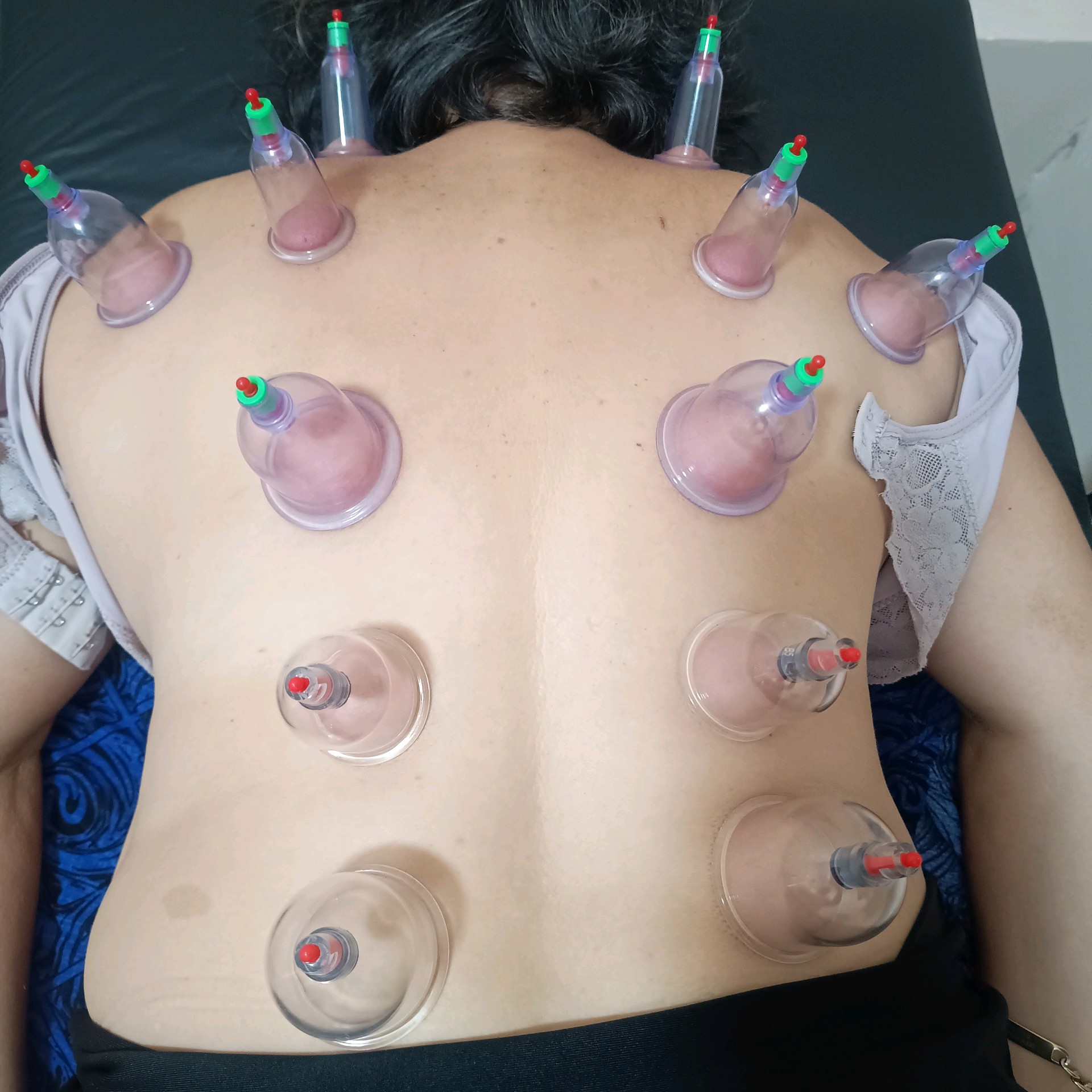 Liberação Miofacial Pacote Evolução