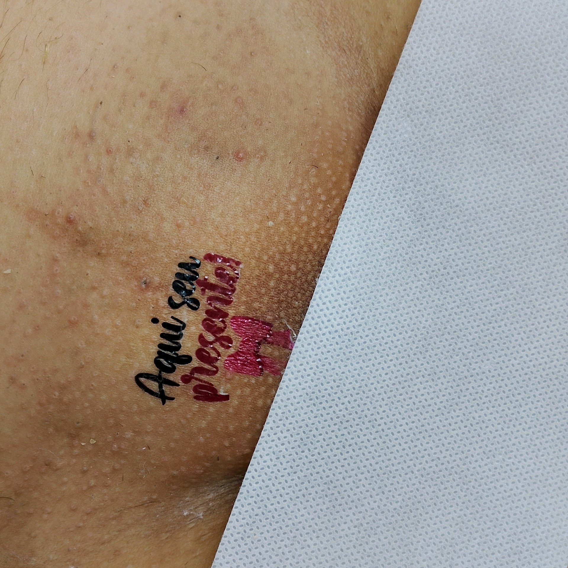 Virilha total (ânus) + tattoo íntima