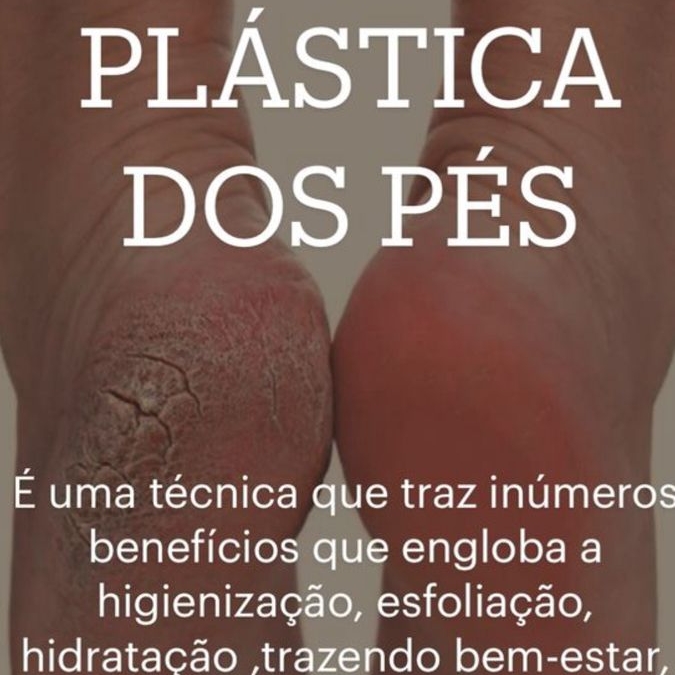 Plástica dos pés