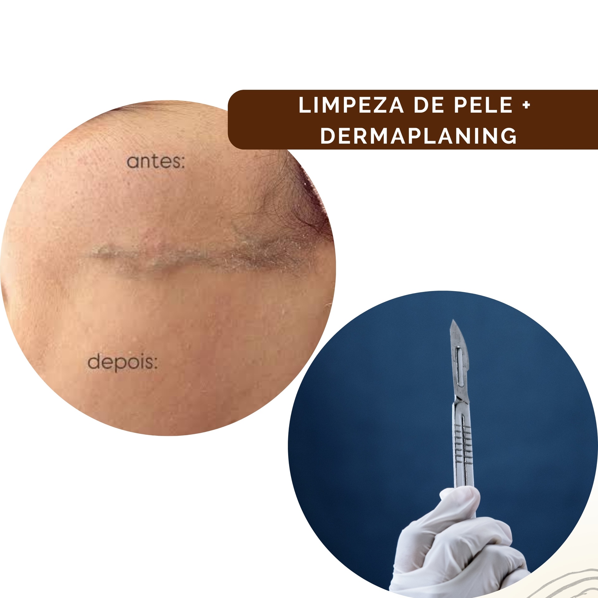 Limpeza + Dermaplaning
