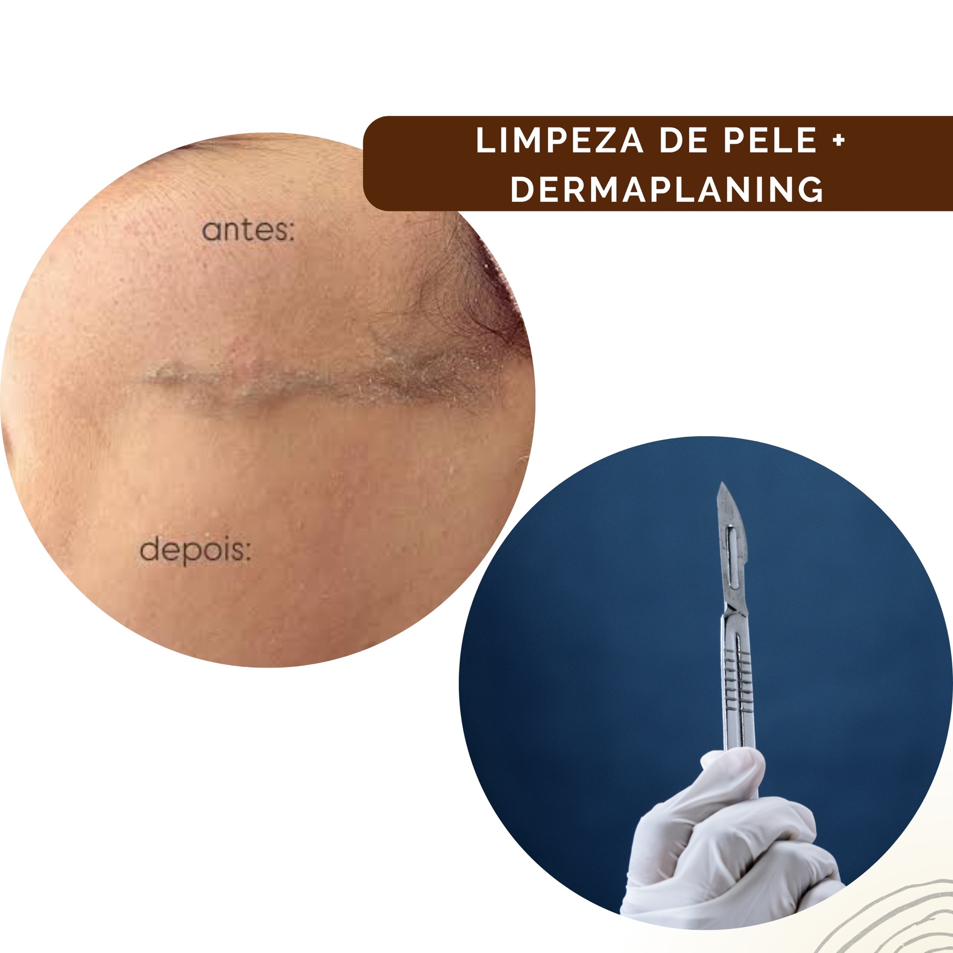 Limpeza + Dermaplaning 2 sessões