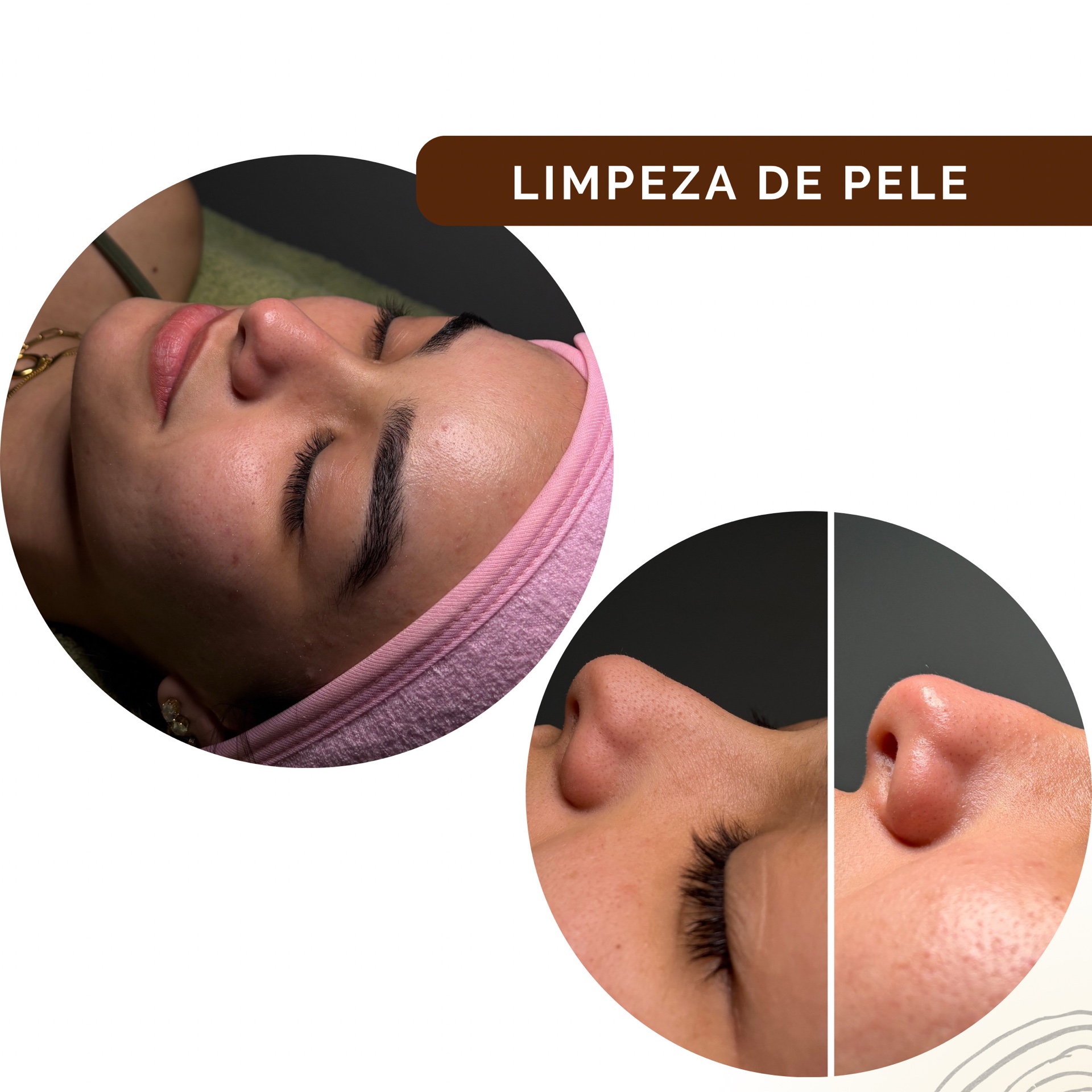 Limpeza de pele