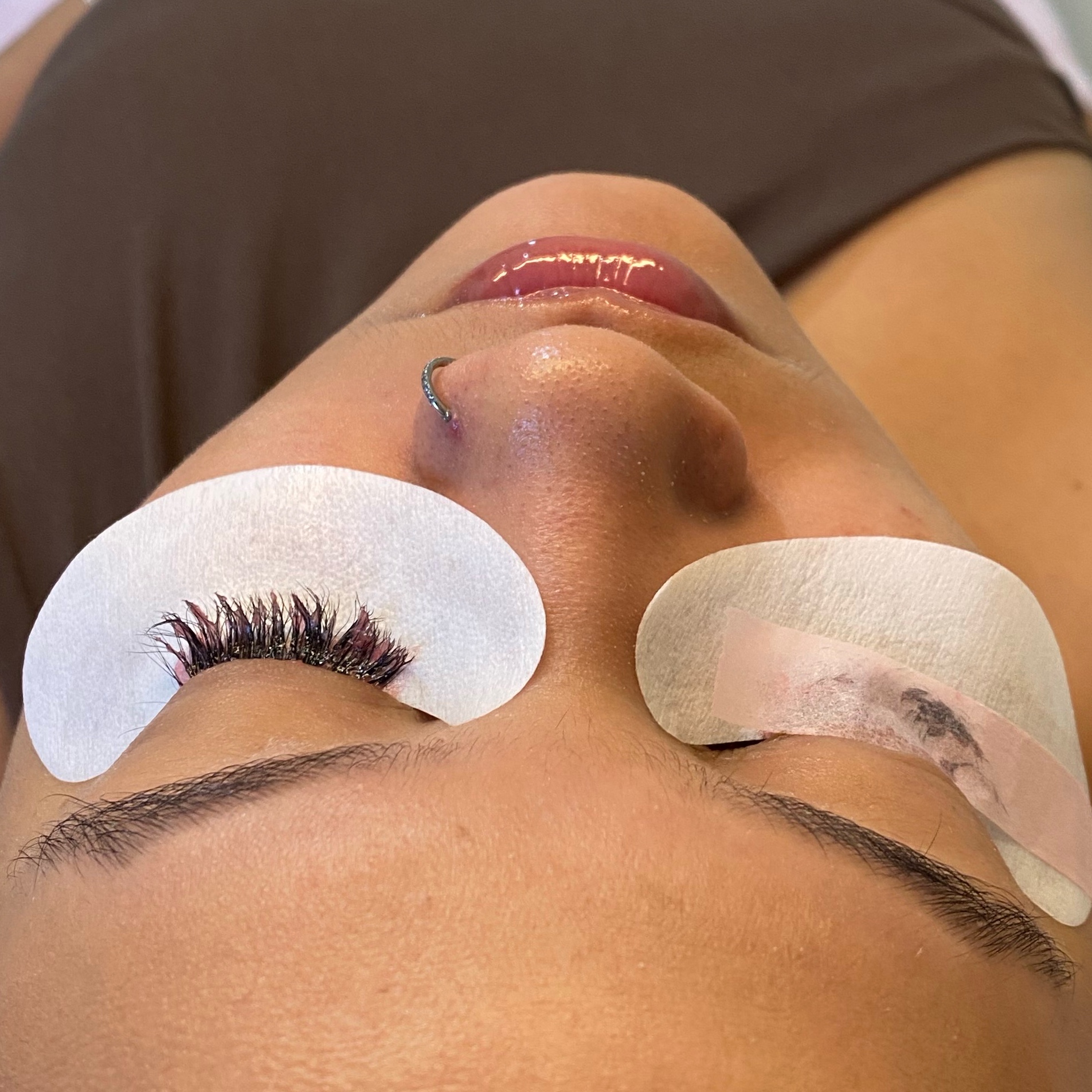 remoção de cílios