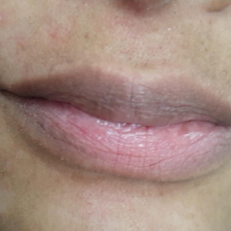 Buço (Epilação Egípcia)