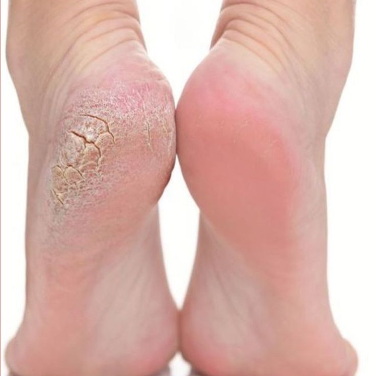 SPA dos pés com pedicure em domicílio