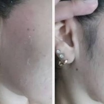 costeleta/costelaria