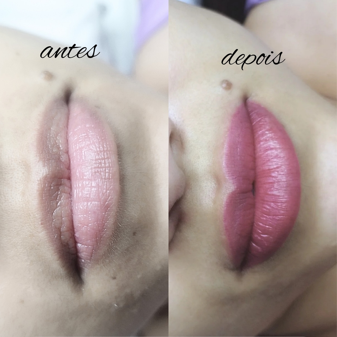MICROPIGMENTAÇÃO DE LÁBIOS + 1 RETOQUE - Durabilidade de 1-2 anos. Procedimento feito com gel anestésico. *Mais informações sobre o procedimento estão no nosso catálogo do Whatsapp.* Agendamento mediante pagamento de sinal.