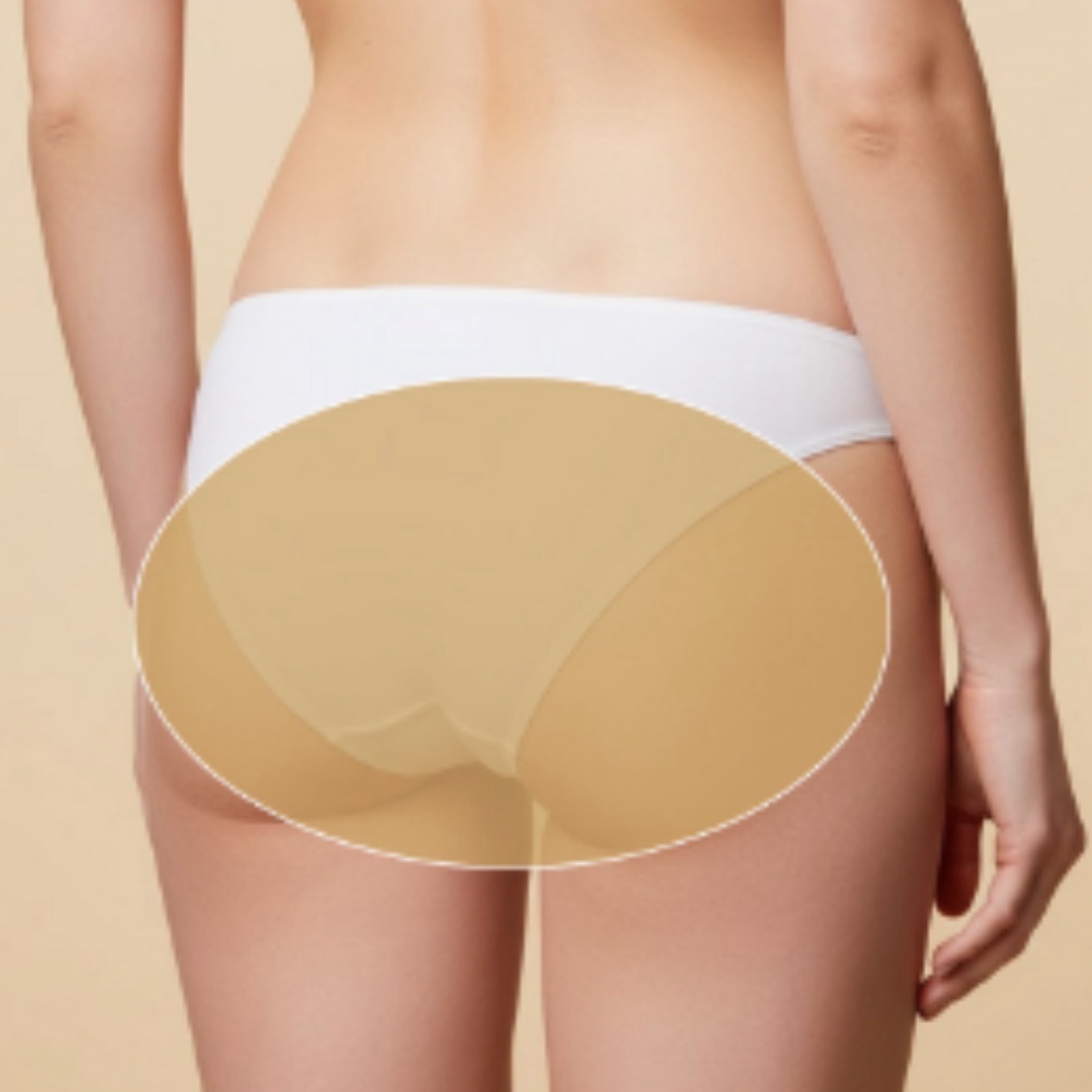 Gluteos
