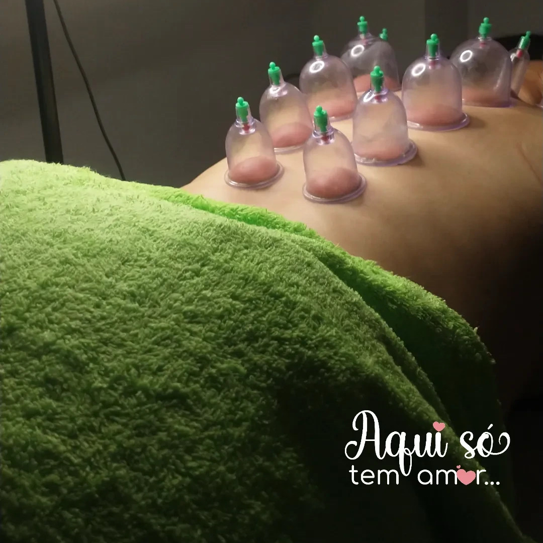Massagem Relaxante Com ventosas