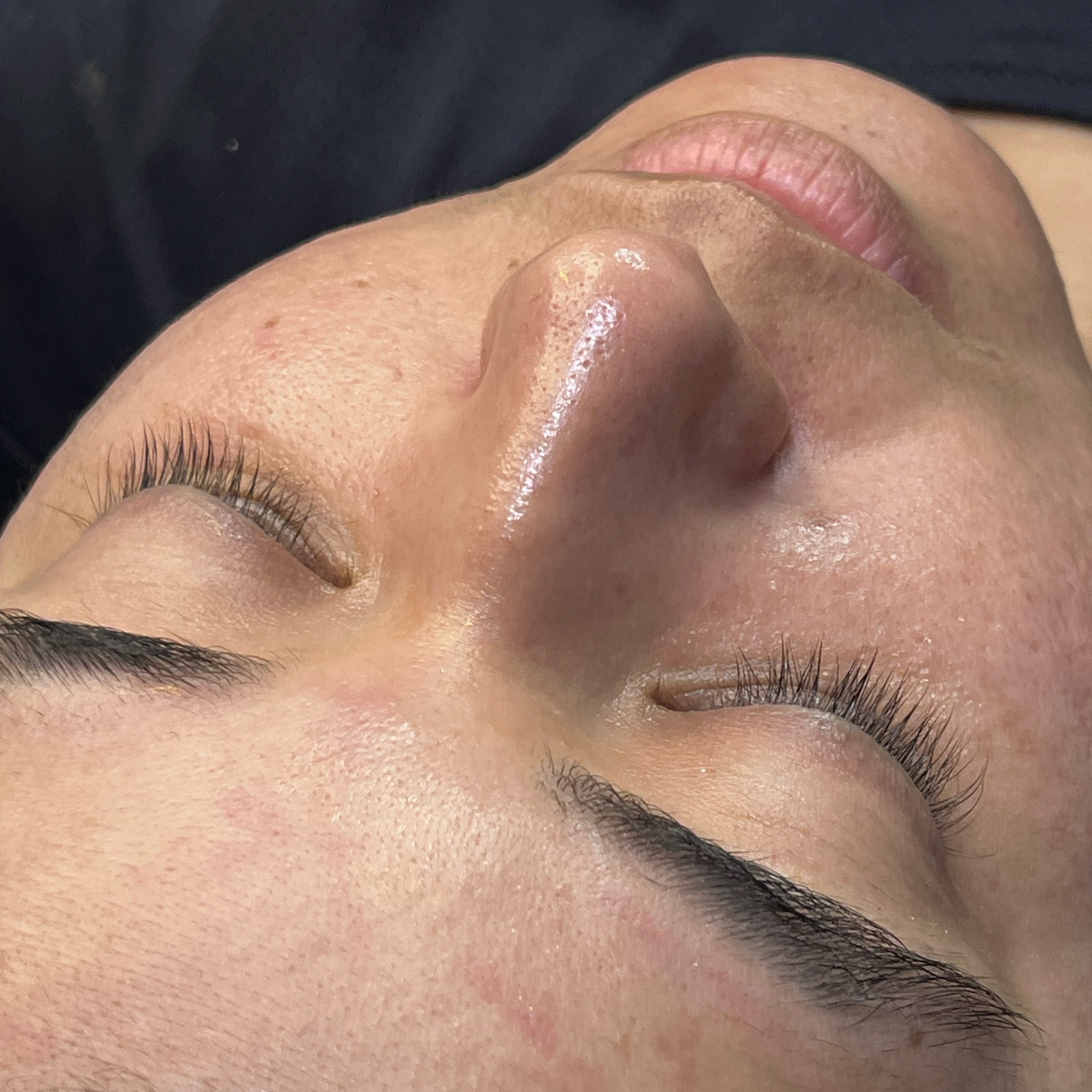 Promoção limpeza de pele 3D