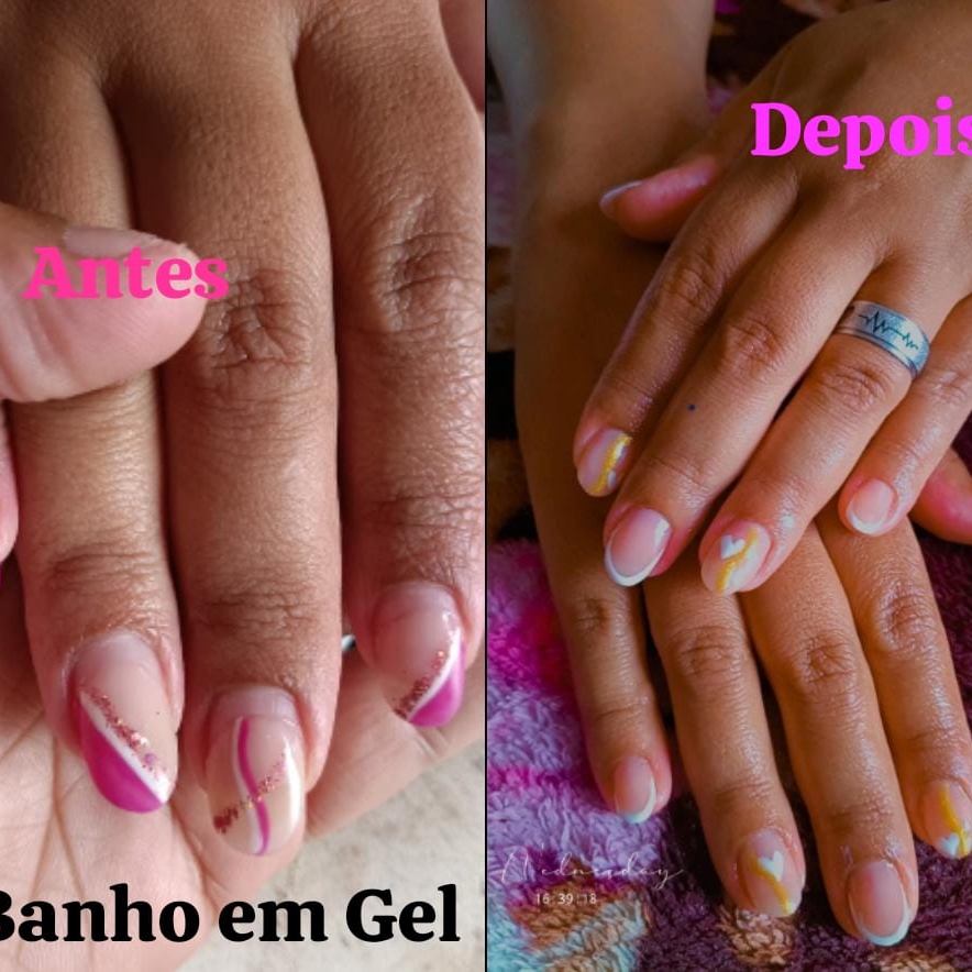 banho de gel