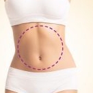 Epilação barriga