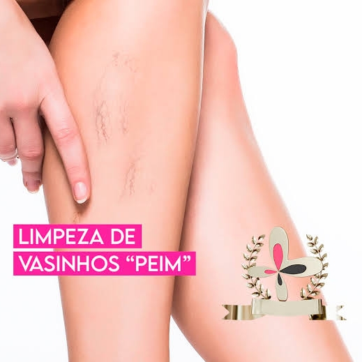 Secagem de Microvasos/ sessão