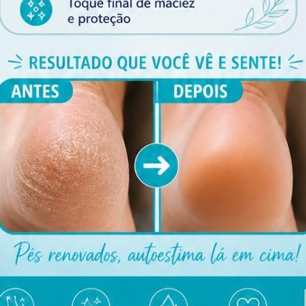 PLÁSTICA DOS PÉS
