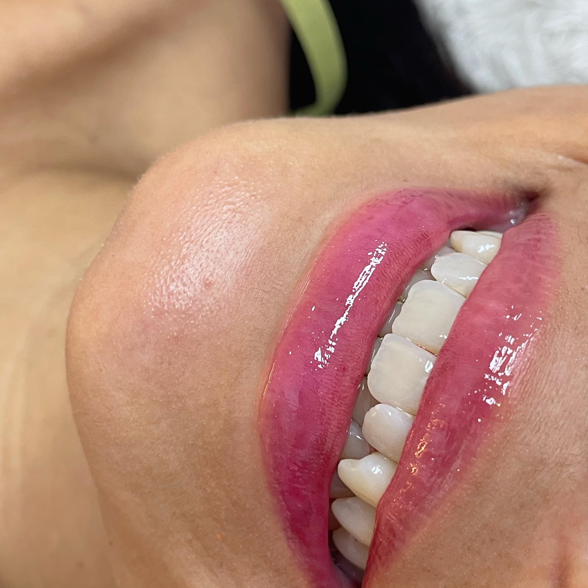 Hydra Gloss