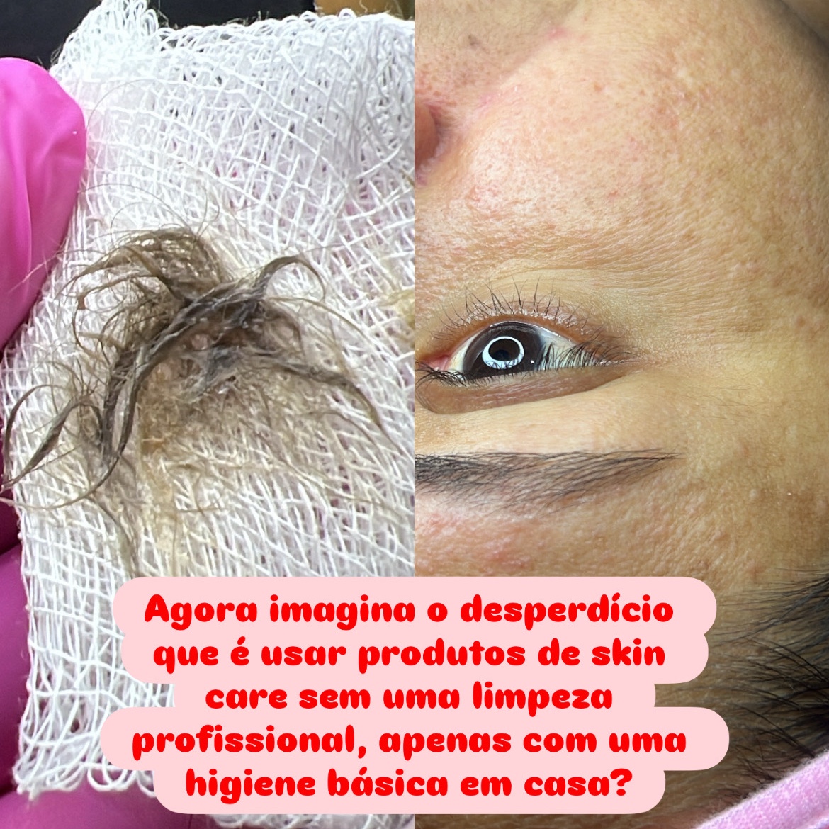 Limpeza de pele + Dermaplaning