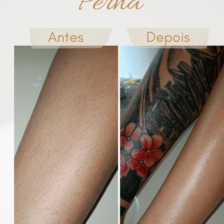 epilação meia perna
