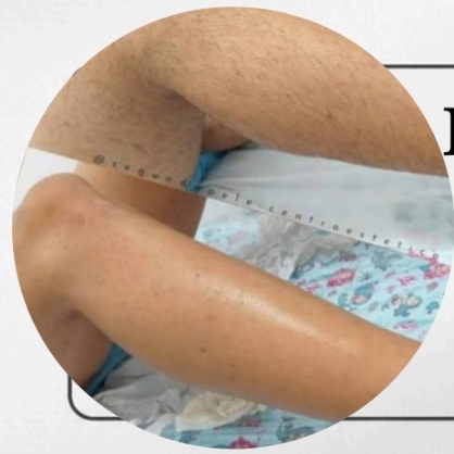 Epilação Perna completa