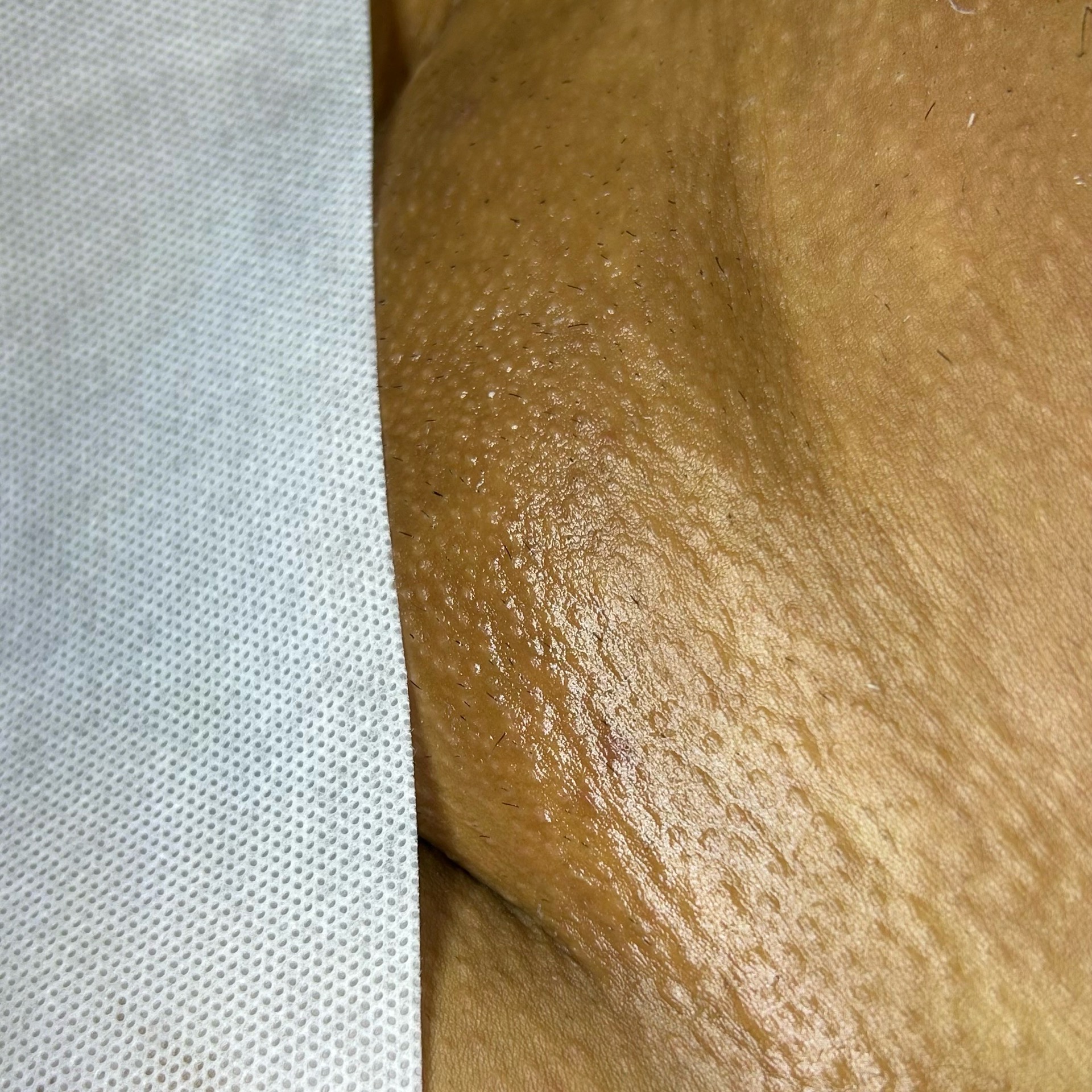 virilha completa