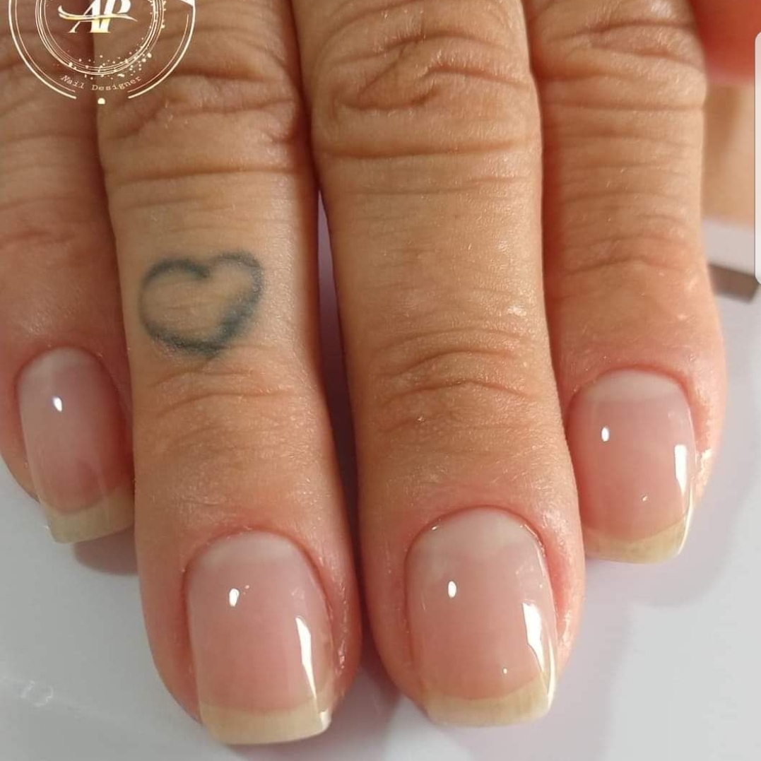 Alinhamento de lâmina+esmaltação em gel