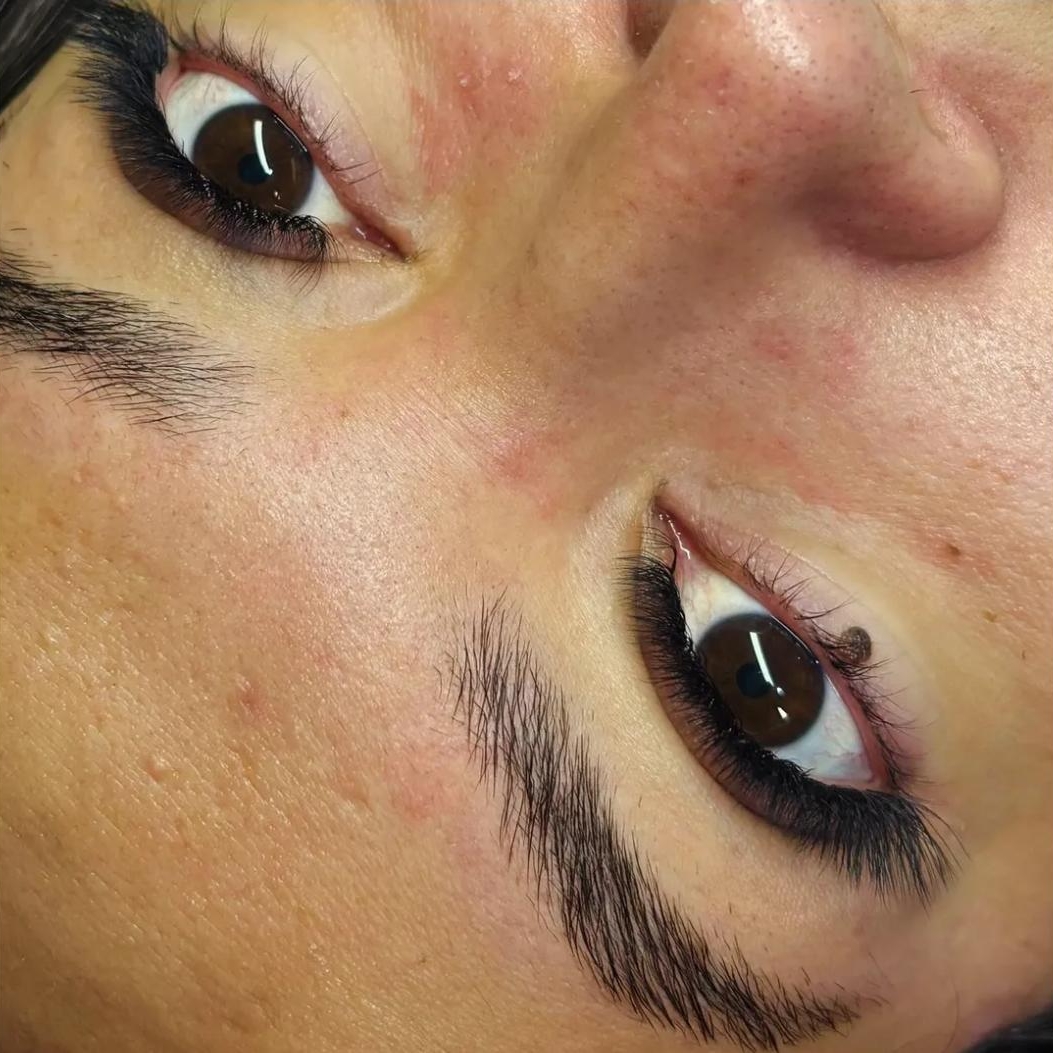 efeito Fox eyes