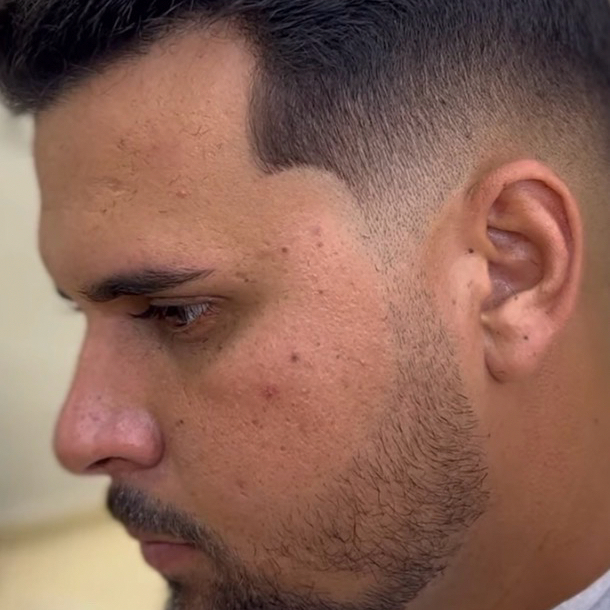 Cabelo e barba masculina