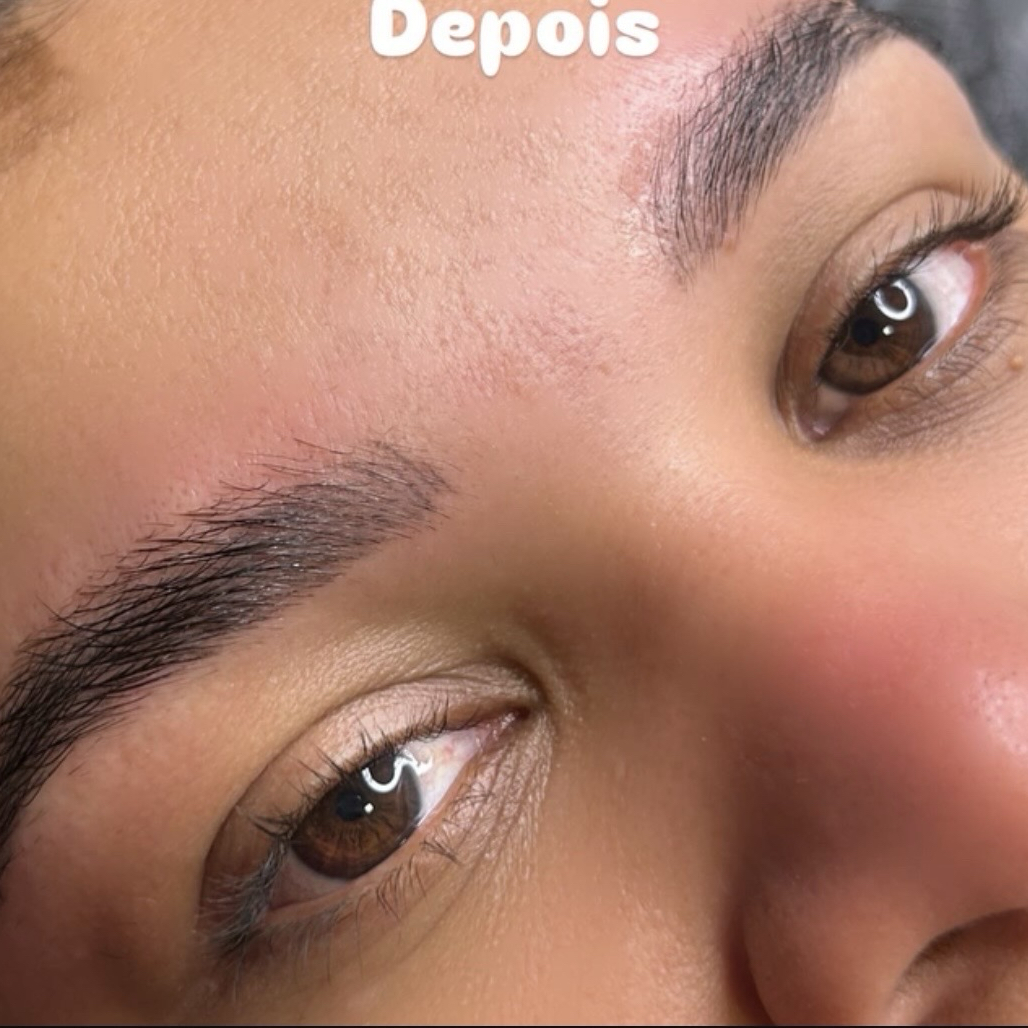 brow lumination