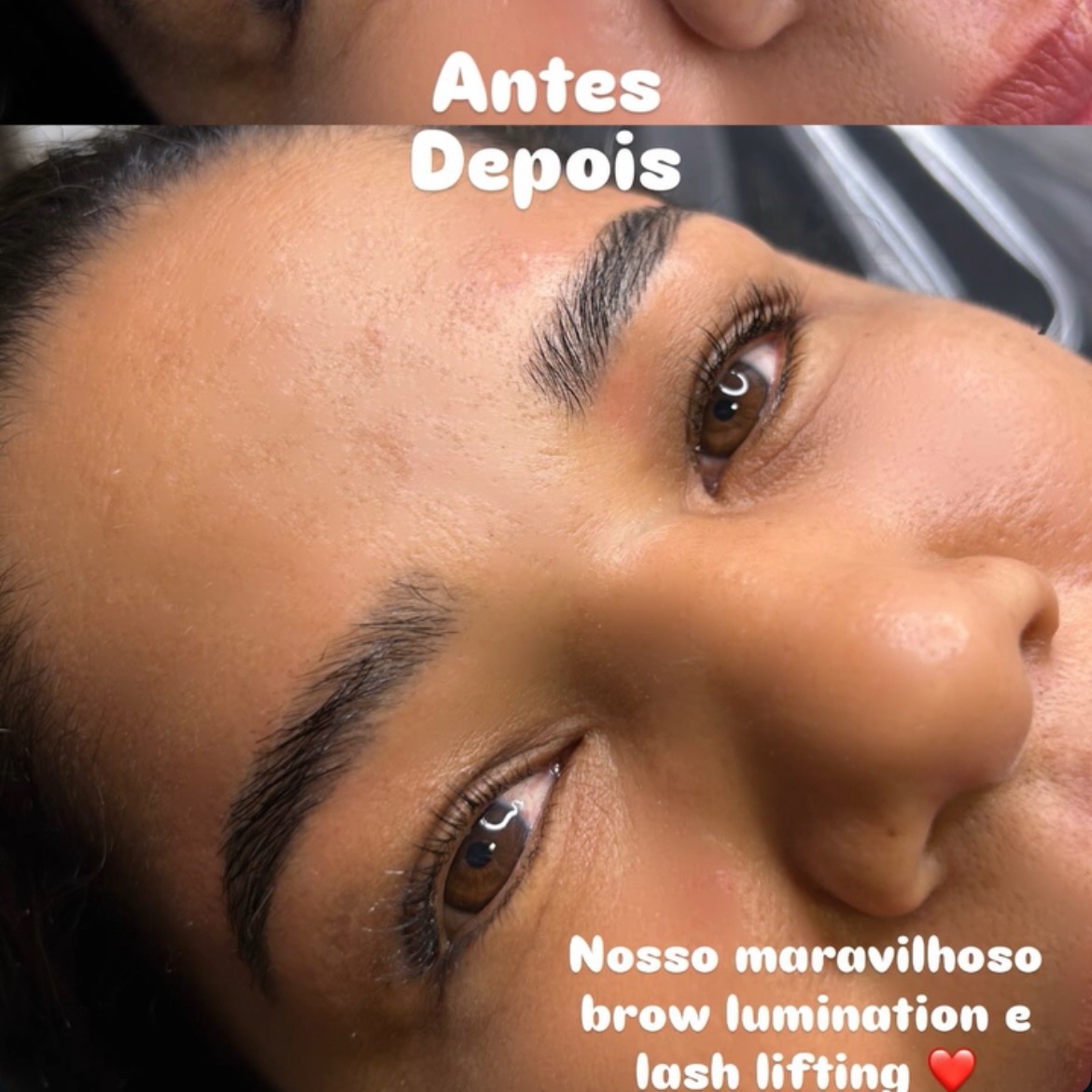 lash lifting